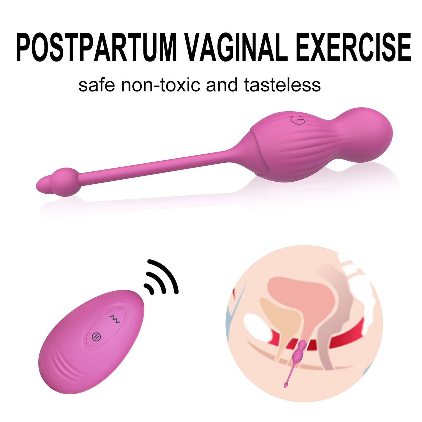 WINYI Sextoys Remote Controlled Usb Charging Vibrating Partum Kit Egg Vibrator Wireless Sex Toy For Women